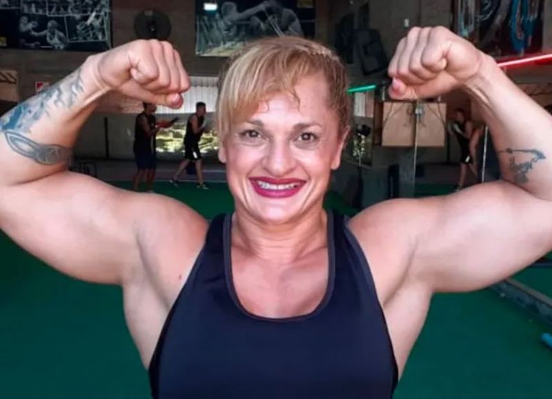 VIDEO | El procedimiento estético de "Locomotora" Oliveras que antecedió al desenlace clínico